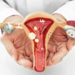 All Gynae Problems, Delivery