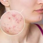 Skin Problems & Dermatology